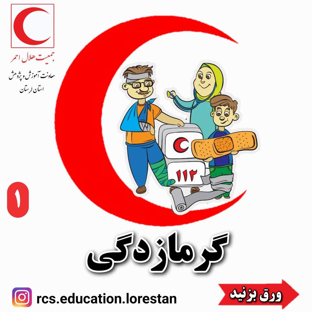گرمازدگی